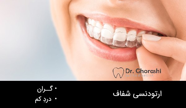 انواع ارتودنسی (ارتودنسی شفاف)
