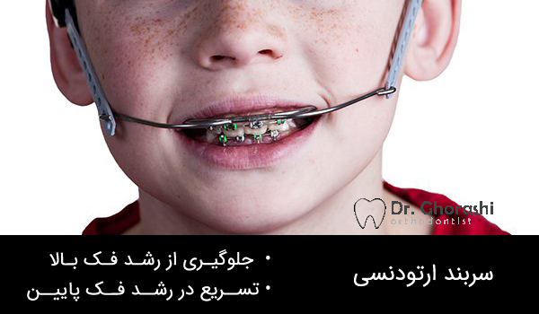 سربند در ارتودنسی دندان