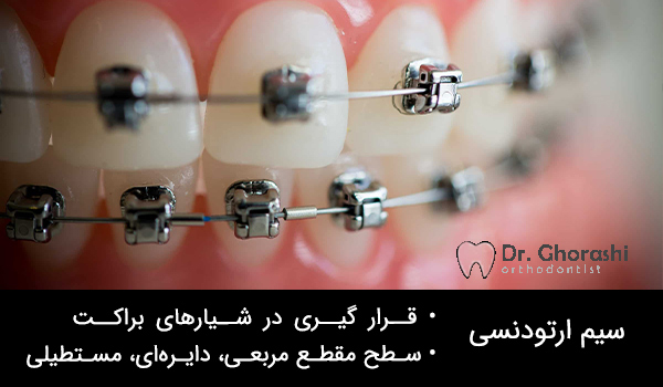 سیم ارتودنسی دندان