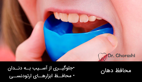 ارتودنسی و محافظ دهان