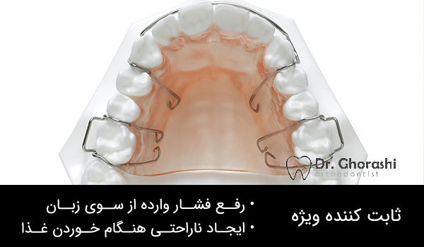 ابزار در ارتودنسی دندان