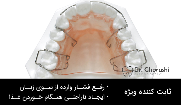 ثابت کننده ویژه در درمان های ارتودنسی