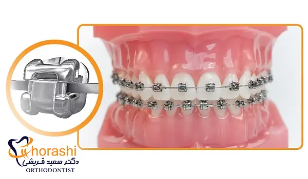 براکت دیمون