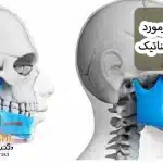 همه چیز درمورد جراحی ارتوگناتیک