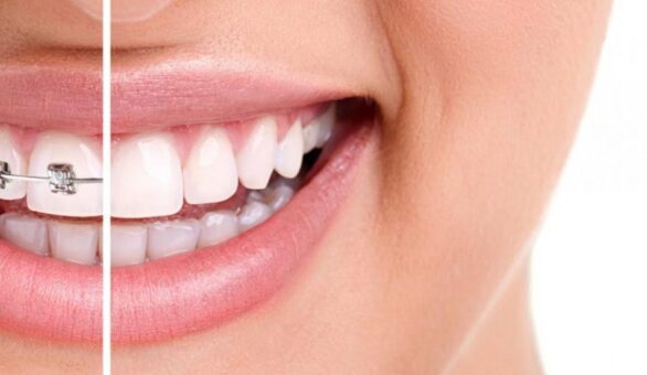 بهترین دکتر برای اصلاح طرح لبخند