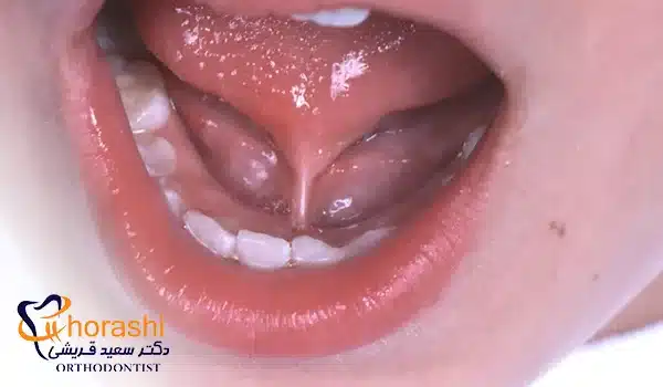 فرنولوم زبان