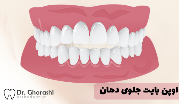 اپن بایت