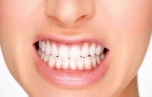 پیشگیری از اروژن دندان
