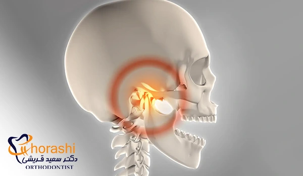 صدا دادن فک به دلیل اختلال مفصل گیجگاهی