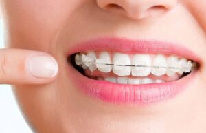 کدام بیمه هزینه دندانپزشکی را می‌دهد؟