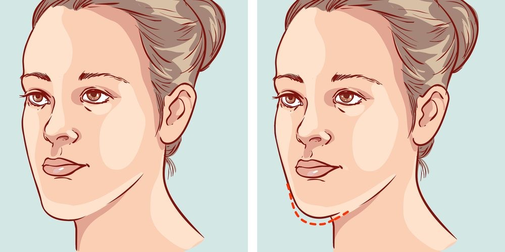 پس از اصلاح آندربایت