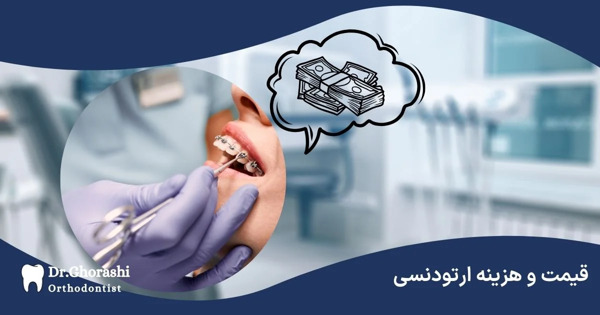 قیمت و هزینه ارتودنسی