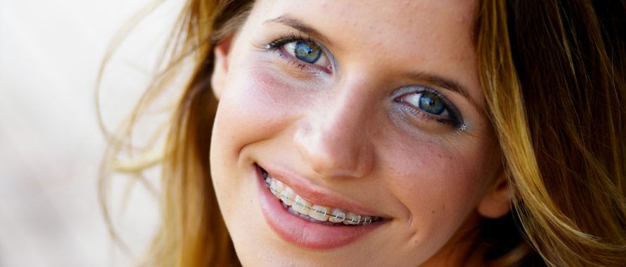 تفاوت هزینه انواع روش های ارتودنسی و سیم کشی دندان