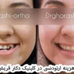 هزینه ارتودنسی