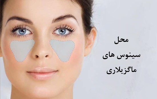 جراحی و عمل لیفت سینوس