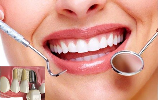 مراقبتهای بعد از سینوس لیفت