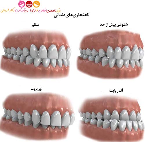 ناهنجاری های دندانی