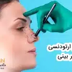 تاثیر ارتودنسی بر بینی