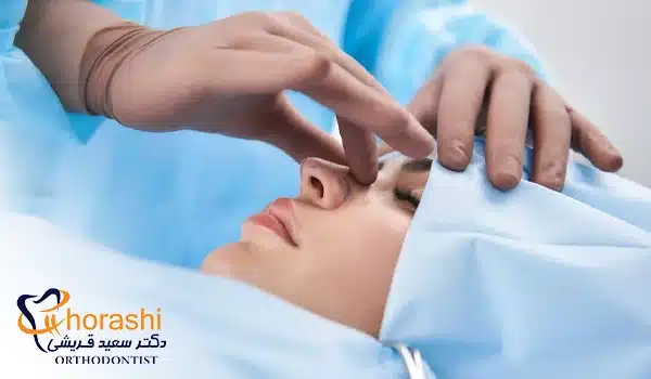 عمل بینی پس از ارتودنسی دندان