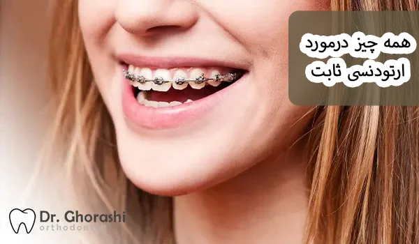 همه چیز درمورد ارتودنسی ثابت