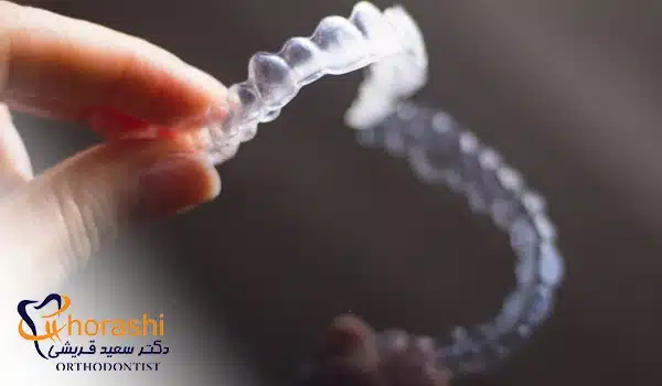 ارتودنسی invisalign