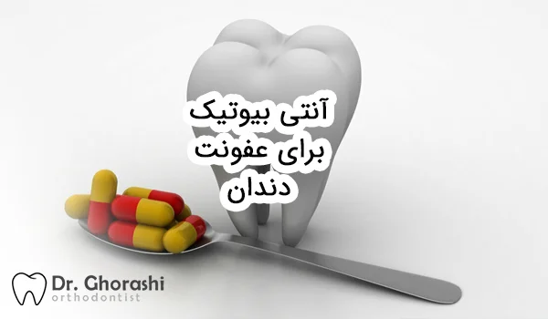 آنتی بیوتیک برای عفونت دندان