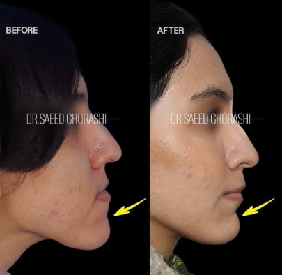 تغییرات فک پس از ارتودنسی در کلینیک تخصصی دکتر قریشی