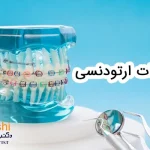 اصطلاحات ارتودنسی