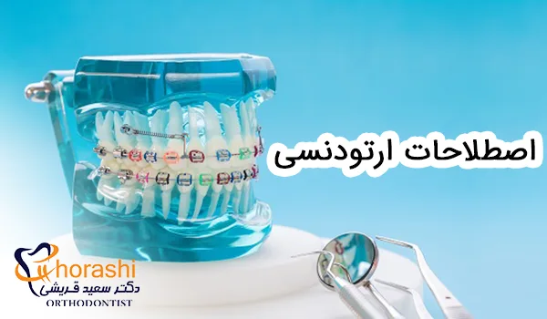 اصطلاحات ارتودنسی
