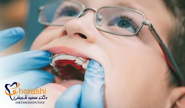 ارتودنسی اینترسپتیو