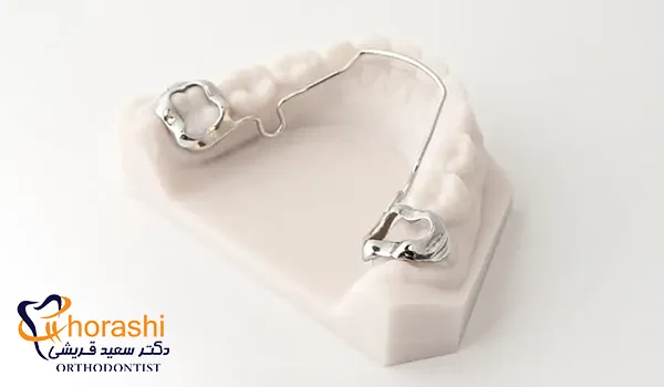 کمان نگهدارنده پشت دندان
