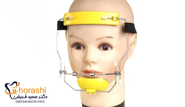 فیس ماسک ارتودنسی