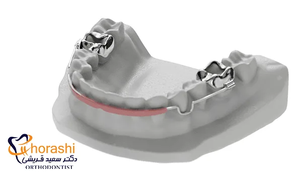 ضربه گیر لب در درمان ارتودنسی
