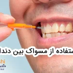نحوه استفاده از مسواک بین دندانی