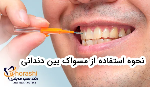 نحوه استفاده از مسواک بین دندانی