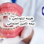 هزینه ارتودنسی با بیمه تامین اجتماعی