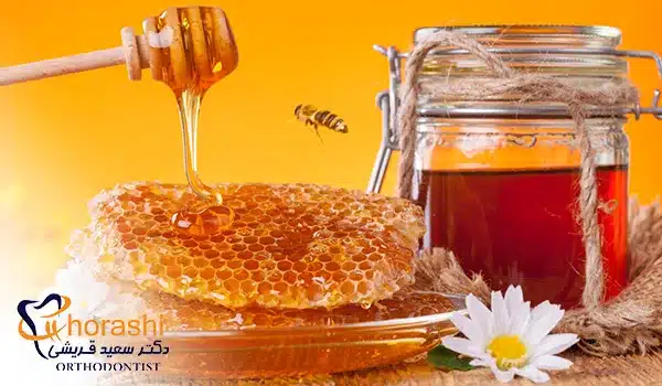 درمان عفونت لثه با عسل