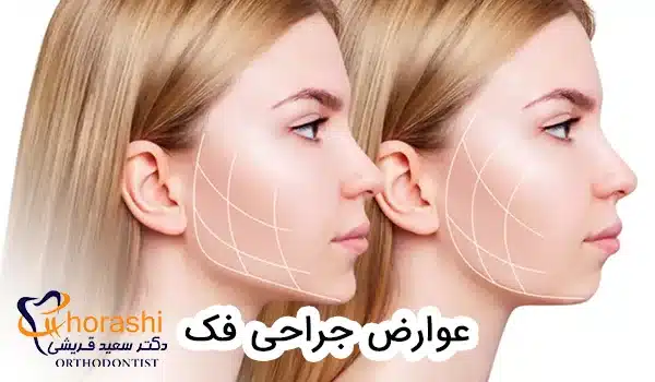 عوارض جراحی فک
