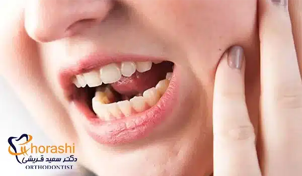 گرفتگی و درد مفصل گیجگاهی یکی از عوارض احتمالی عمل جراحی فک