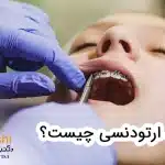 دیباند ارتودنسی چیست؟