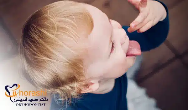 درمان سه سوته آفت دهان کودک