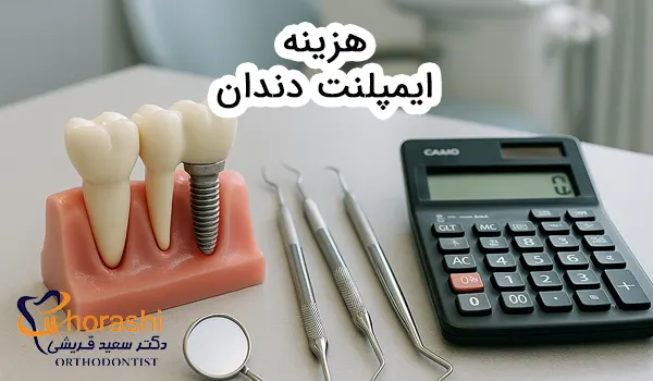 هزینه ایمپلنت دندان