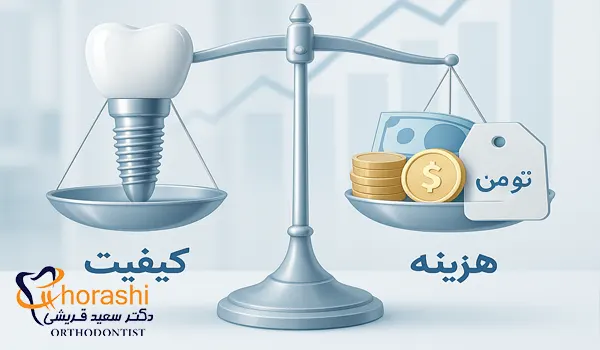 عوامل موثر بر هزینه ایمپلنت دندان در تهران