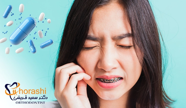 مسکن برای درد ارتودنسی