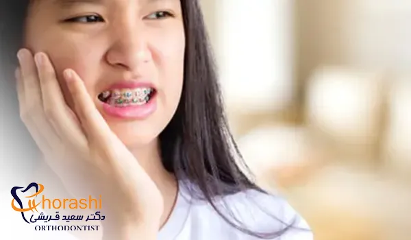 تسکین خانگی درد ناشی از بریس ارتودنسی