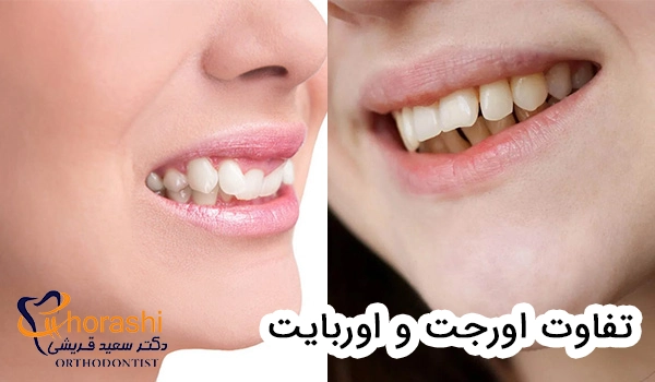 تفاوت اورجت و اوربایت
