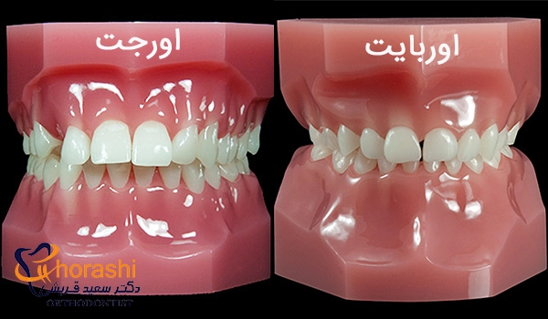 مقایسه اورجت و اوربایت