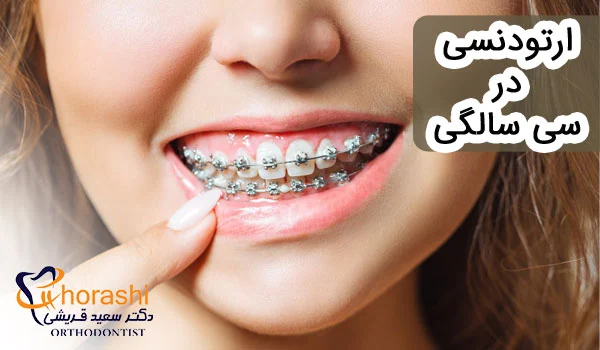ارتودنسی در سی سالگی