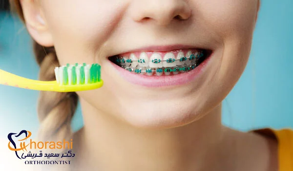 مراقبت های ارتودنسی در 30 سالگی