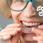 ارتودنسی در 50 سالگی